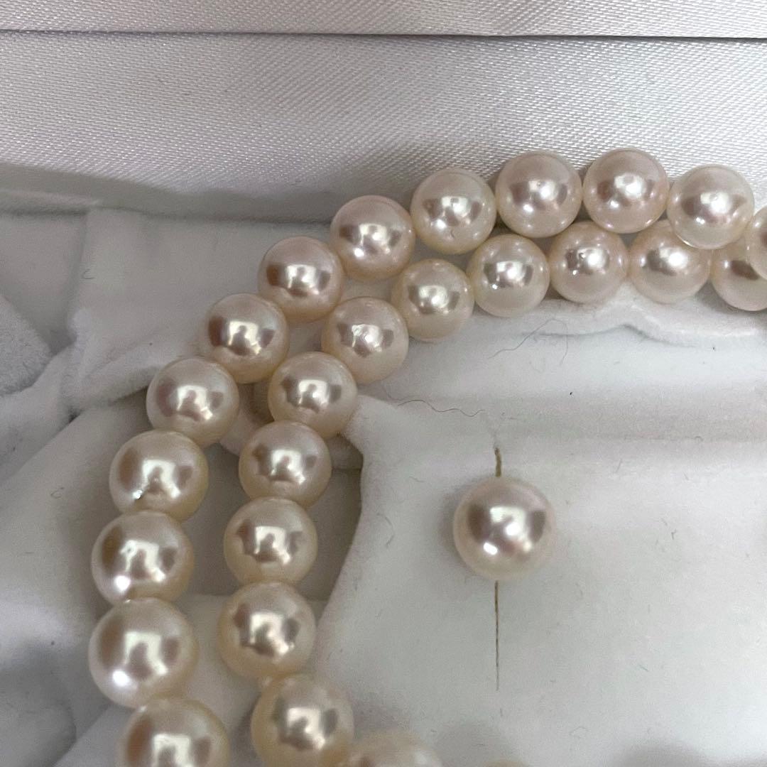 Large Akoya pearl earrings and matching necklace set with 7.5-8mm pearls in a jewelry box