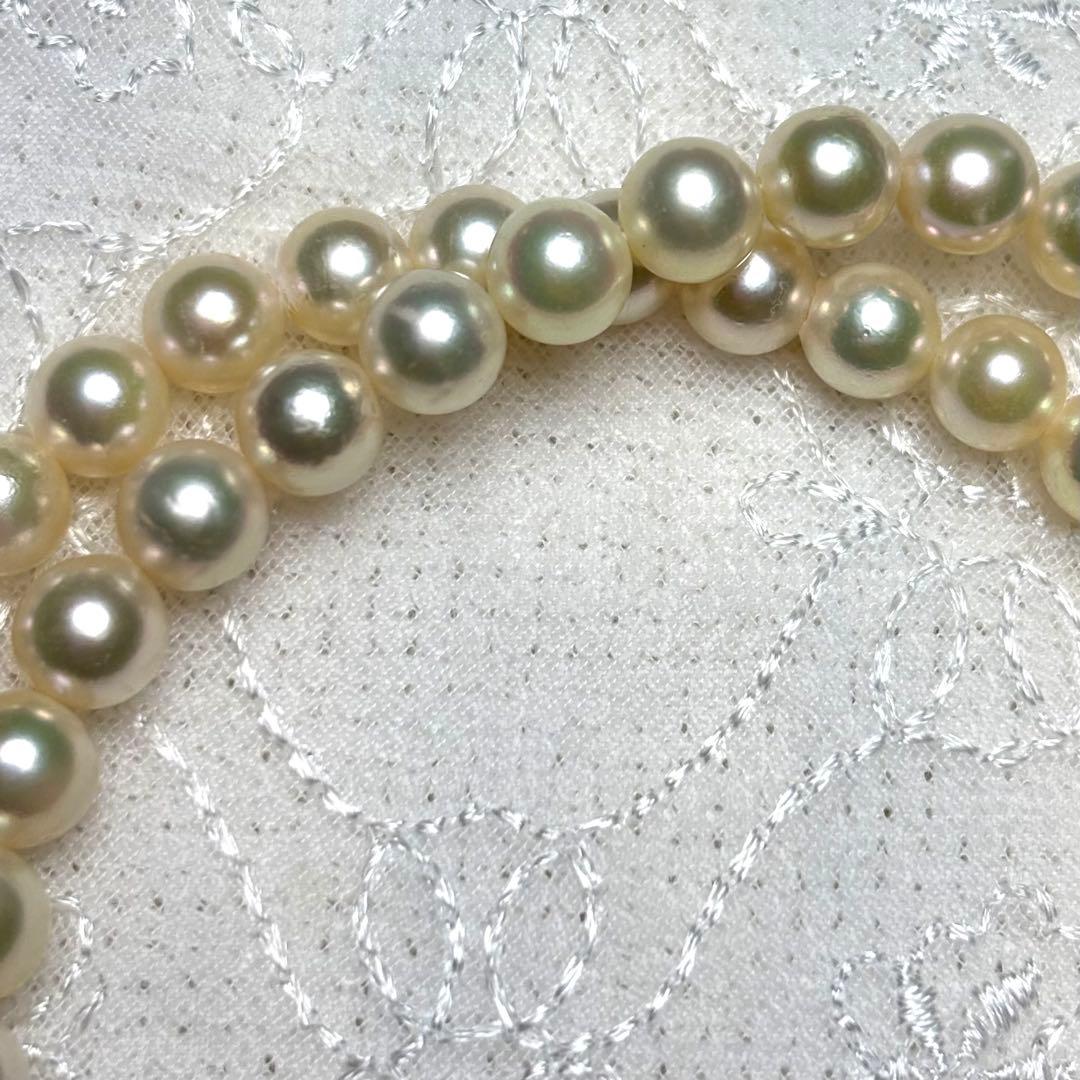Close-up view of Law measuring 43 cm length and 6.5-7.0 mm diameter